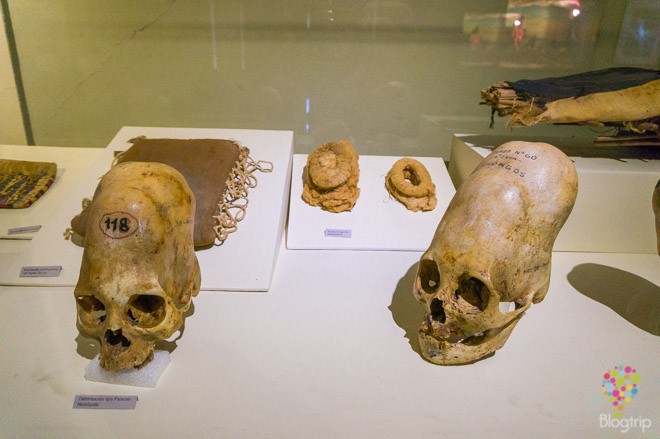 Cráneos vestigios de práctica de trepanación, cultura Paracas Ica Perú